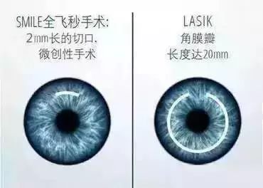 角膜基质细胞，在眼科学领域的关键角色