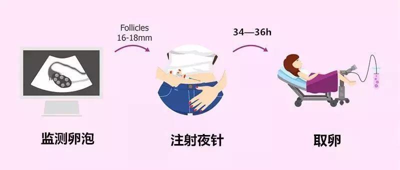 取卵术后的注意事项，守护健康，细节决定成败