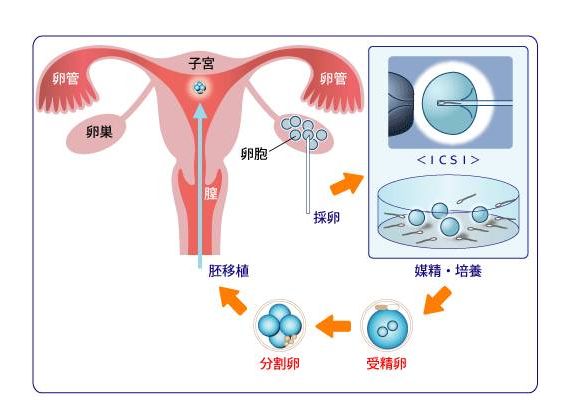 试管取卵，时间与生命的交织