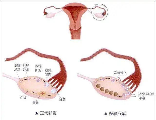 妇科龙，深度拆解与理解